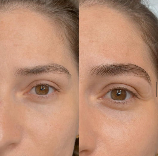 Sobrancelha com técnica de micropigmentação natural
